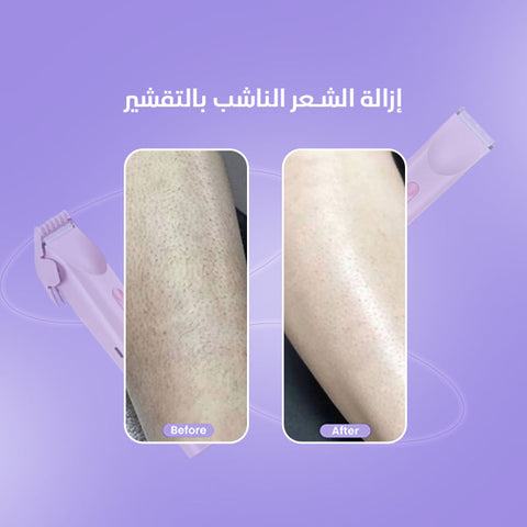 2-in-1 Women's Body Shaver ماكينة حلاقة نسائية 2 في 1 للجسم