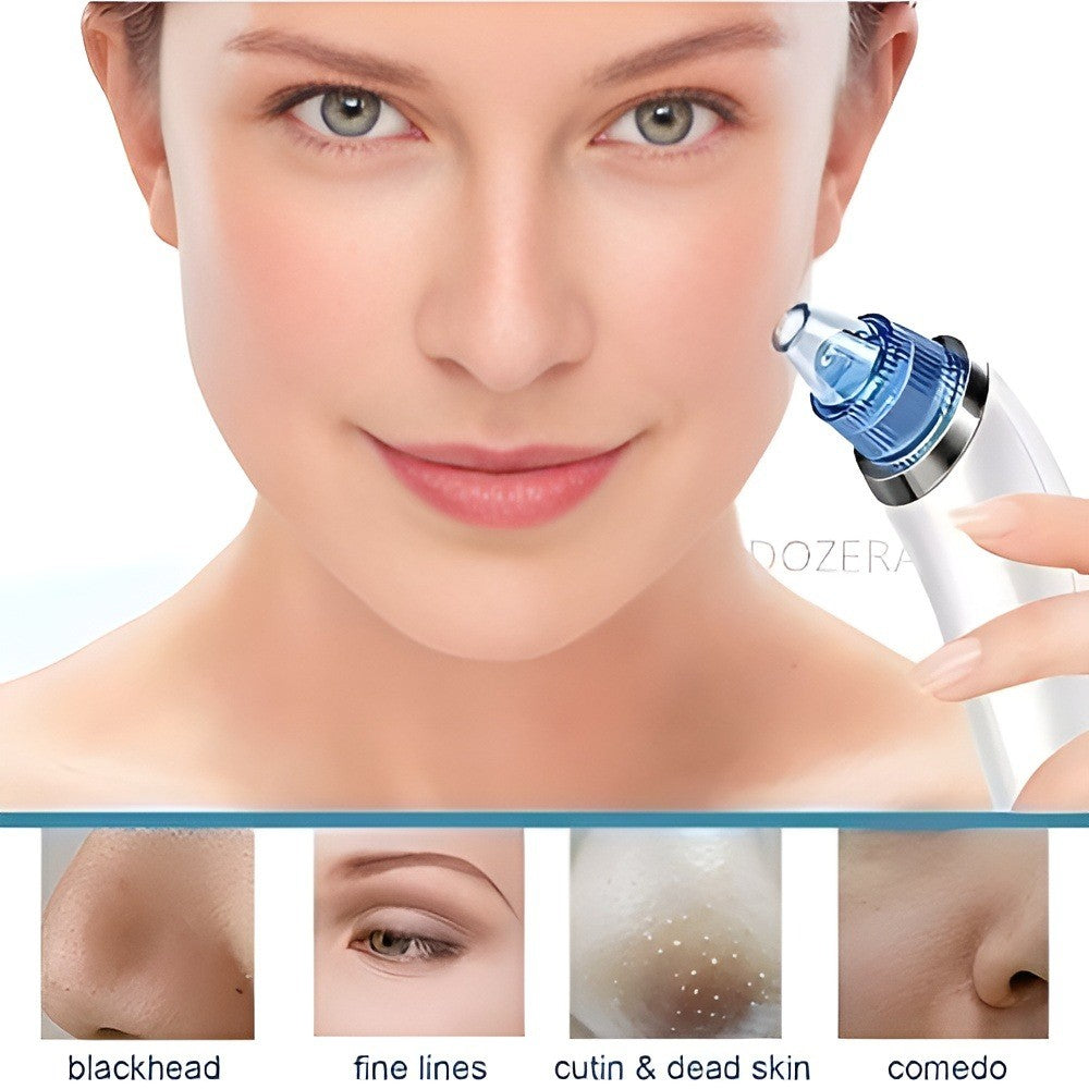 DermaSuction™ Blackhead Vacuum & Deep Pore Cleanser (Original)