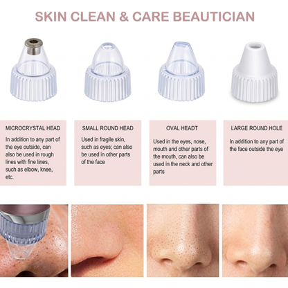 DermaSuction™ Blackhead Vacuum & Deep Pore Cleanser (Original)