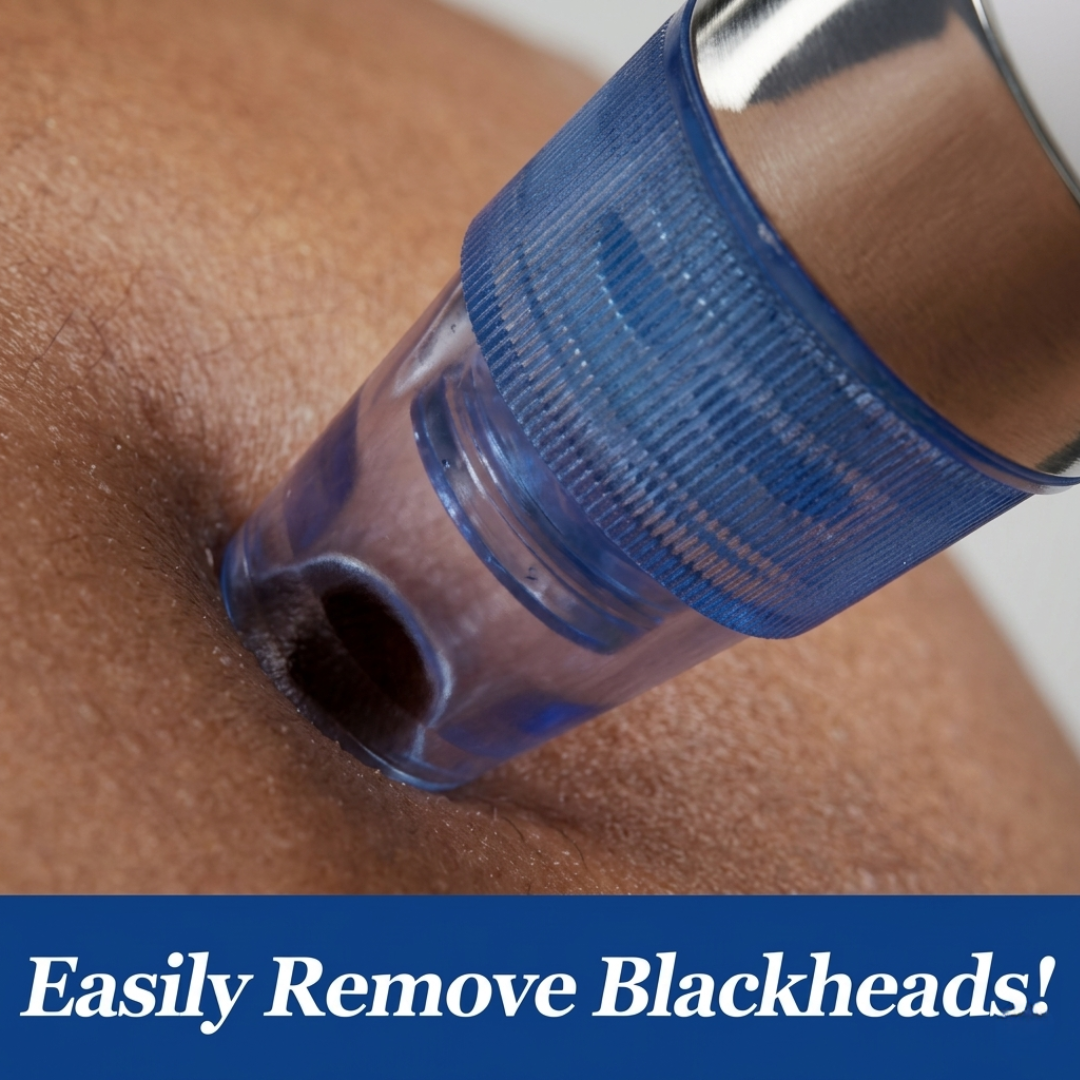DermaSuction™ Blackhead Vacuum & Deep Pore Cleanser (Original)