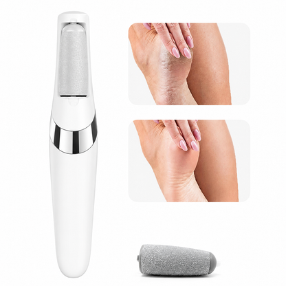 Electric Pedicure Callus Remover