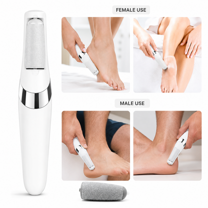 Electric Pedicure Callus Remover